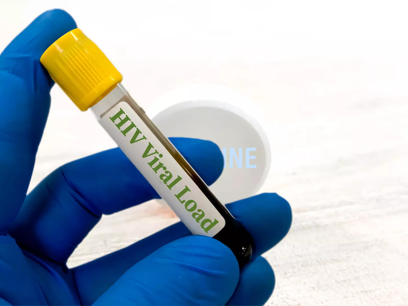 Reasons Women Are Missing HIV Diagnosis And the Solutions Experts Want Now