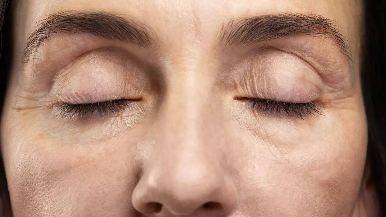 What your eyelashes say about your overall health: 4 conditions you should never ignore