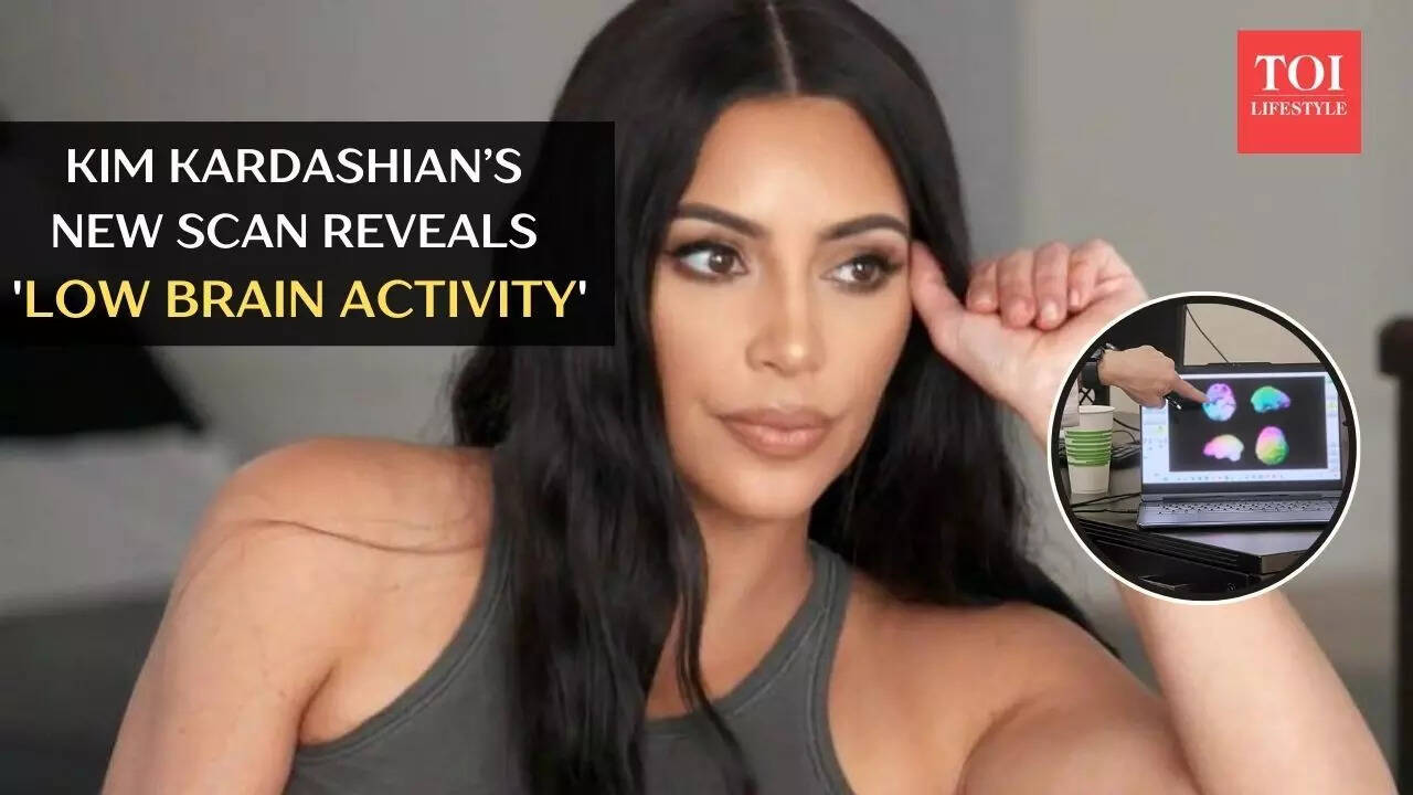 Kim Kardashian’s new scan reveals 'low brain activity'