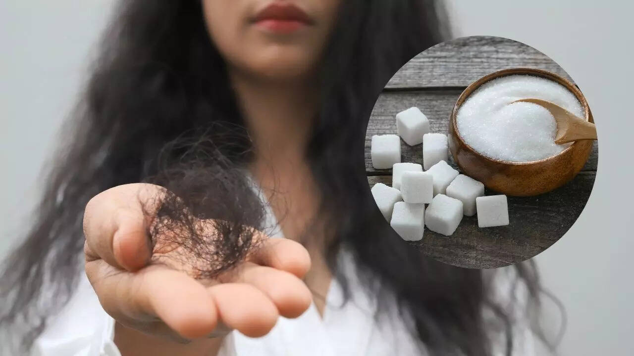 Hair loss could be a sign you’re eating too much sugar; know the warning signals