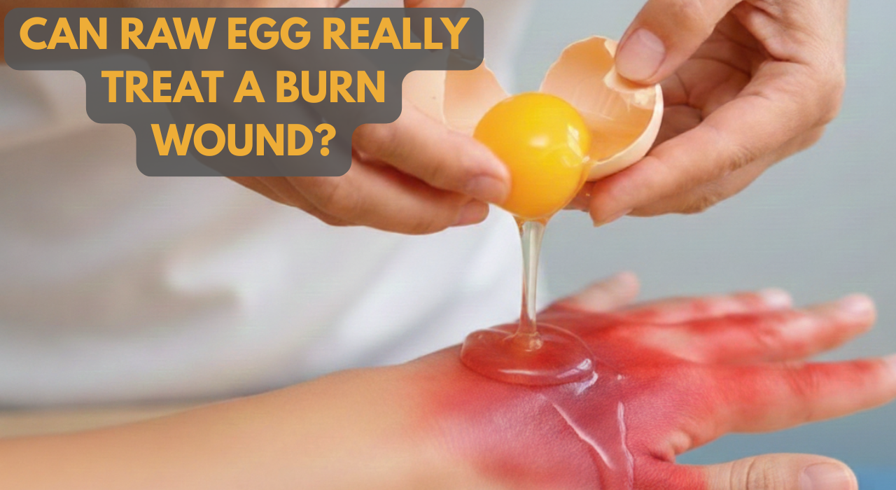 Does egg white really heal burn wounds? Doctors warn of deadly infection risk