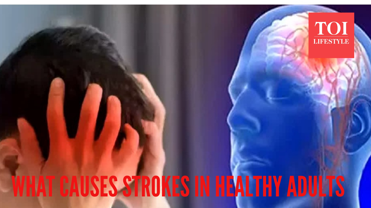 Top neurologist reveals the hidden reasons behind a stroke