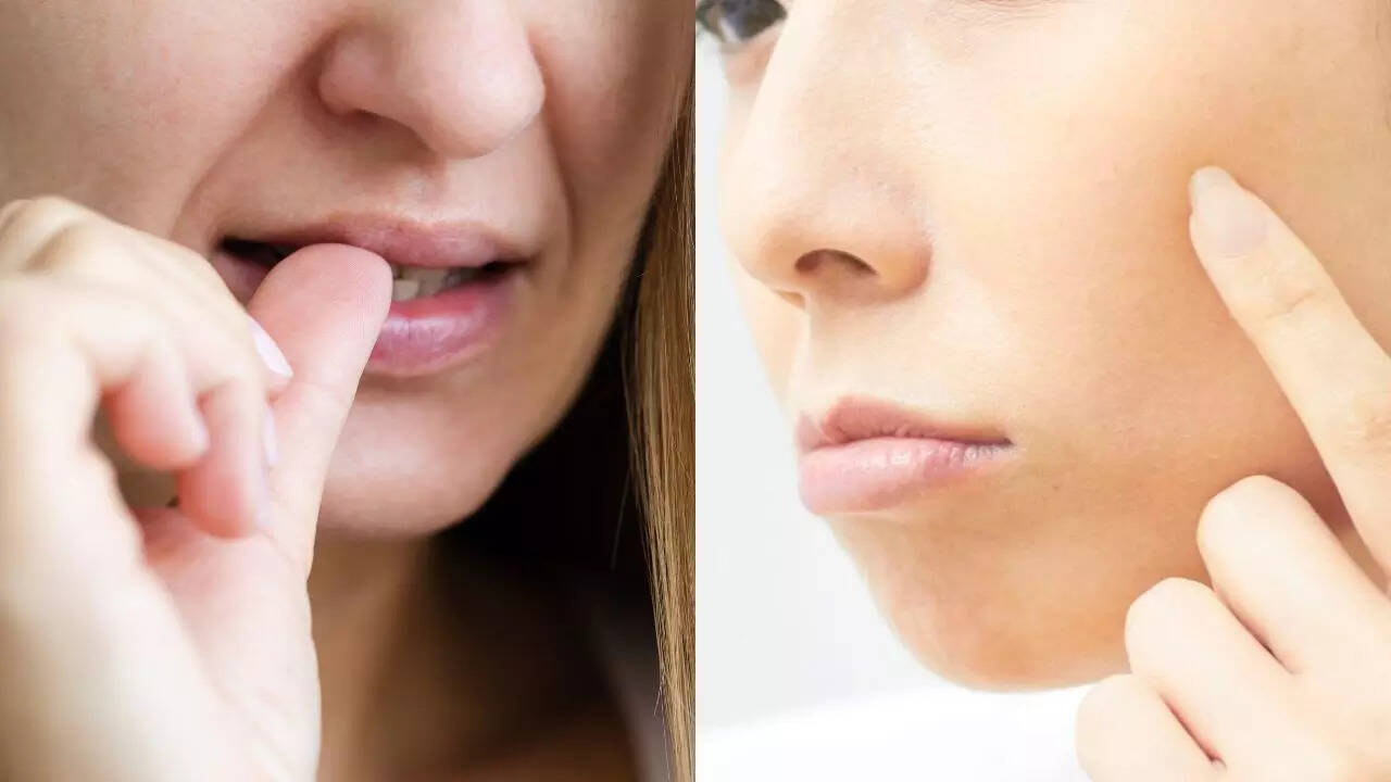 Why you can’t stop picking your skin: Know what really causes it and how you can break the cycle