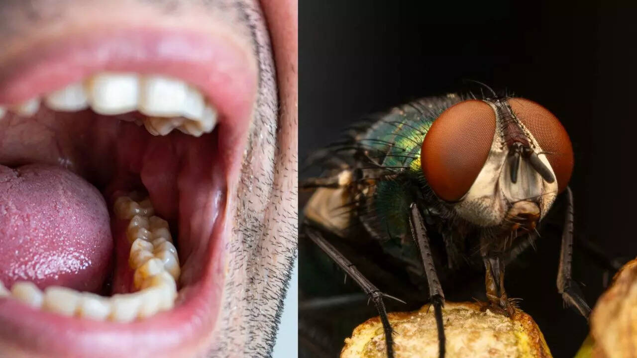 Mouth larvae: How a small fly triggers a dangerous infection; causes, symptoms and treatment explained