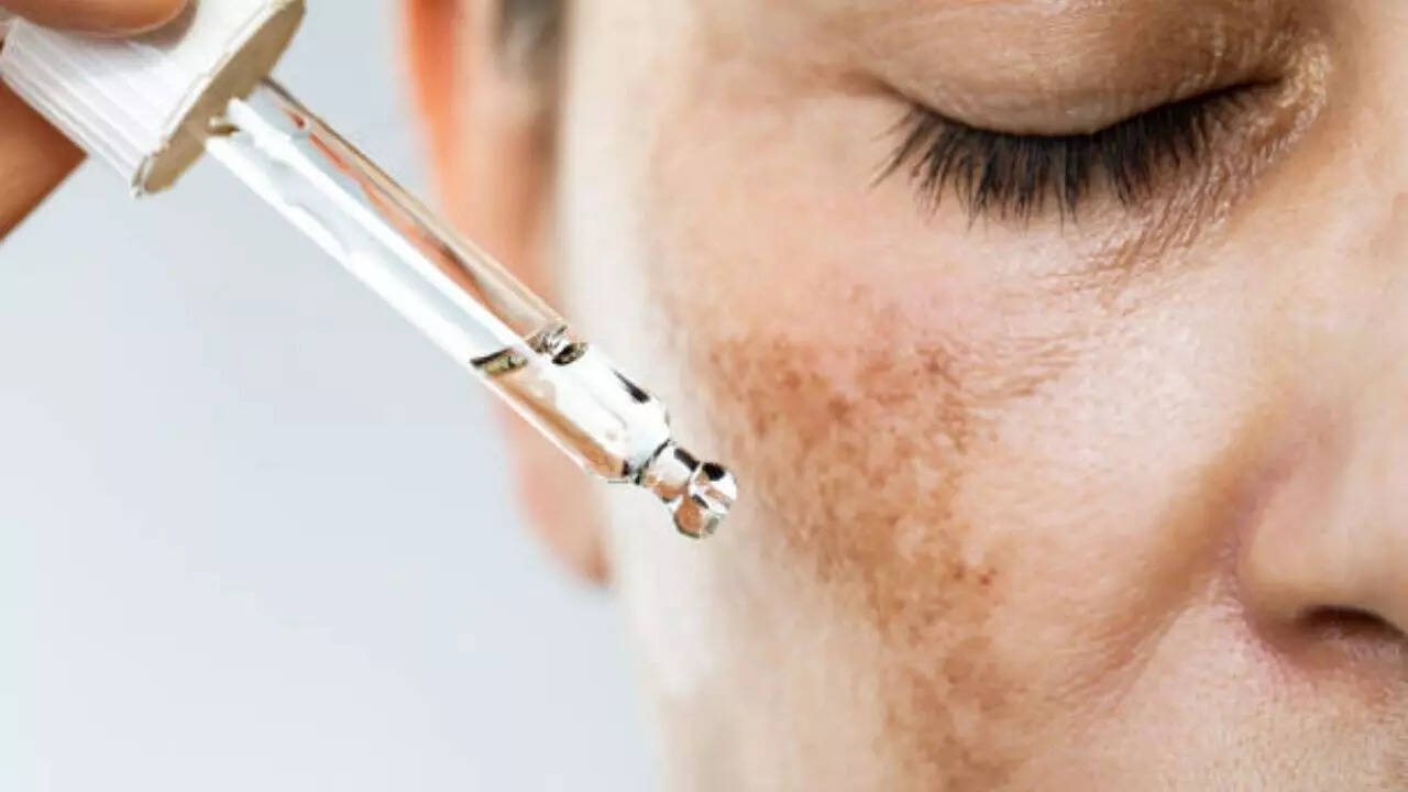 Pigmentation