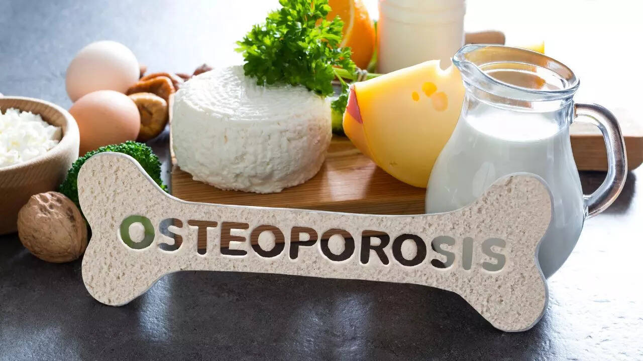 Osteoporosis diet guide: Foods that protect bone density and those that increase fracture risk