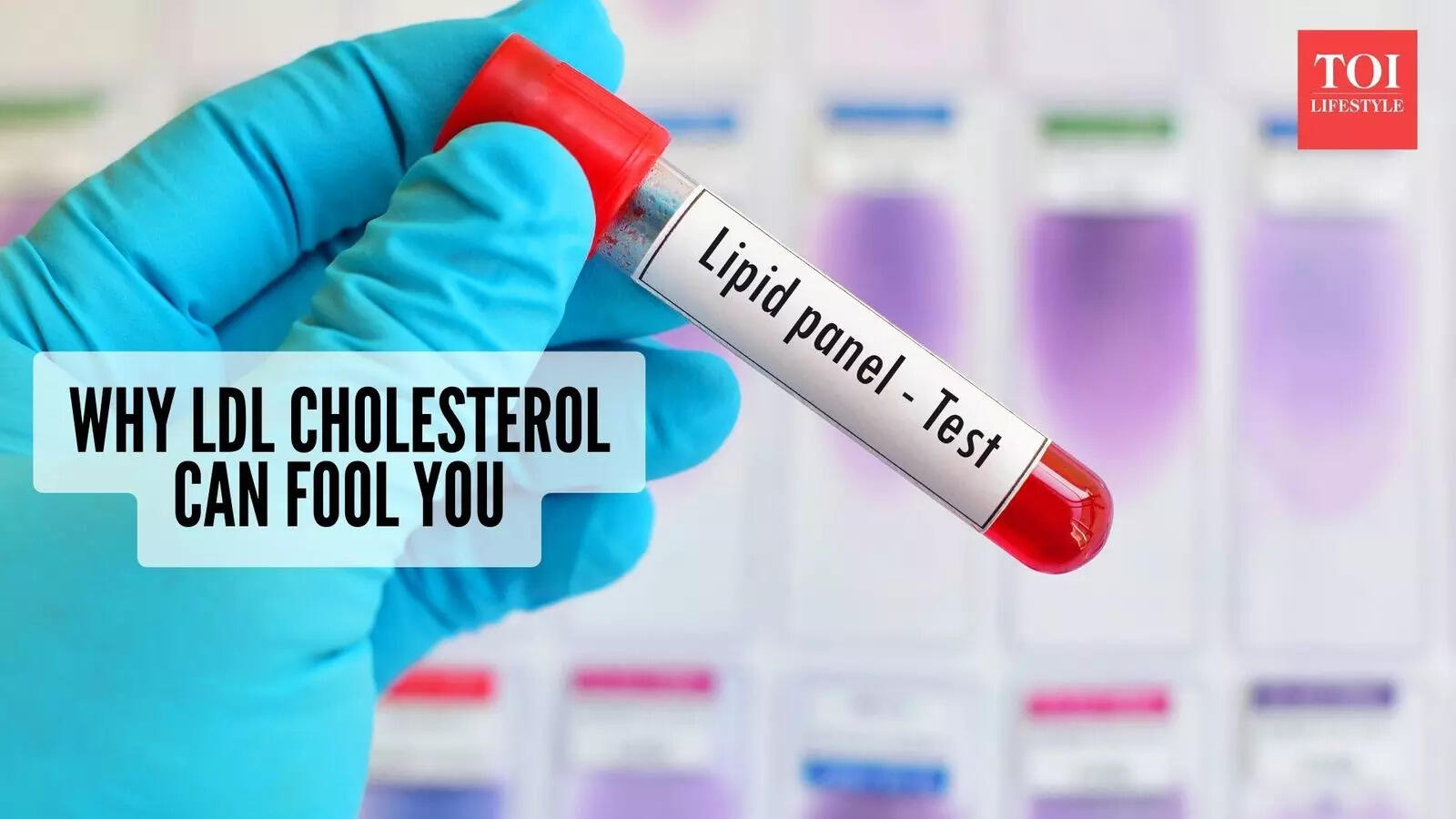 Your cholesterol report may look fine, but here’s what it could be missing