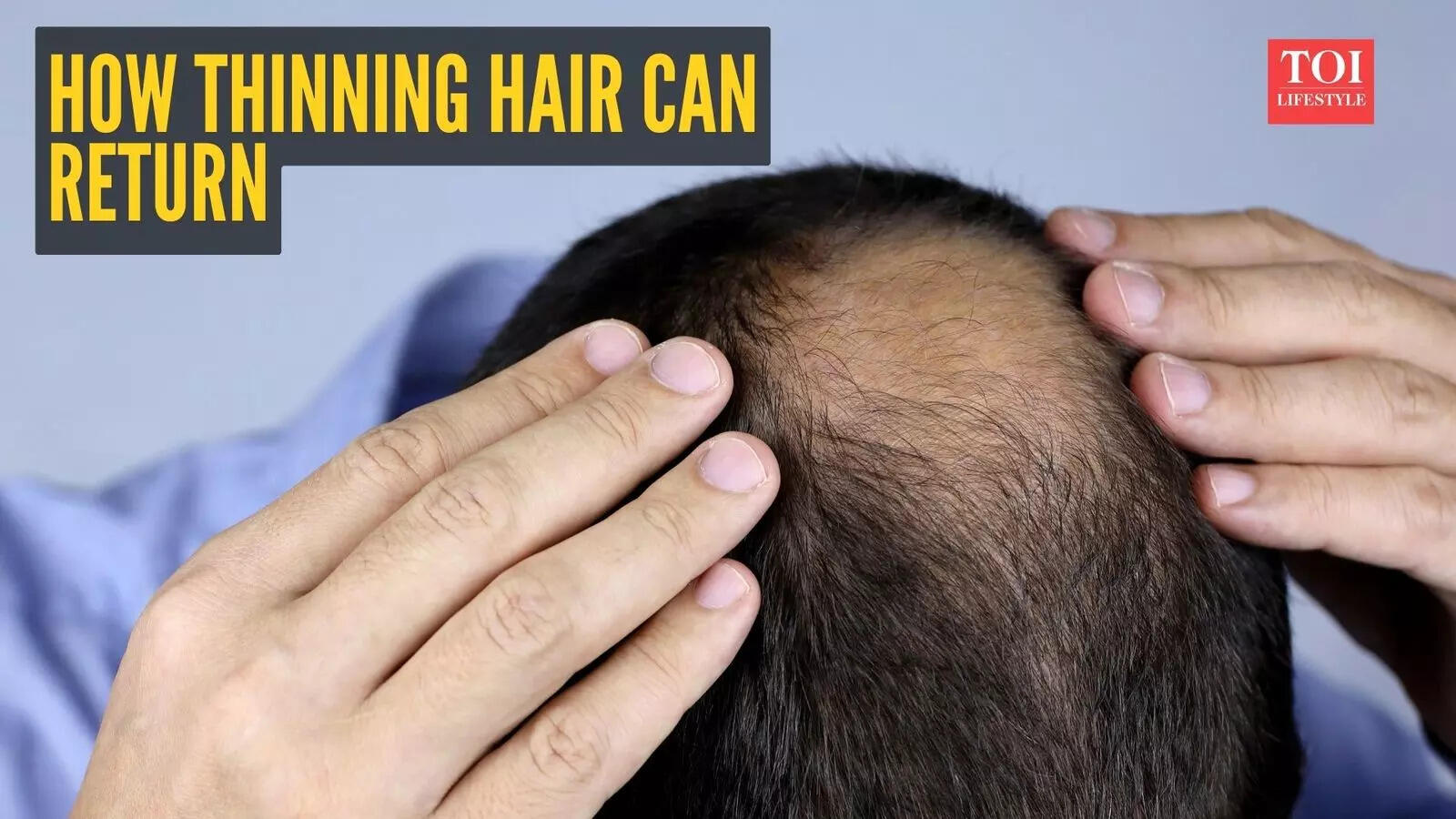 ‘Your hair can come back’: Doctor shares science-backed plan to restore thinning hair