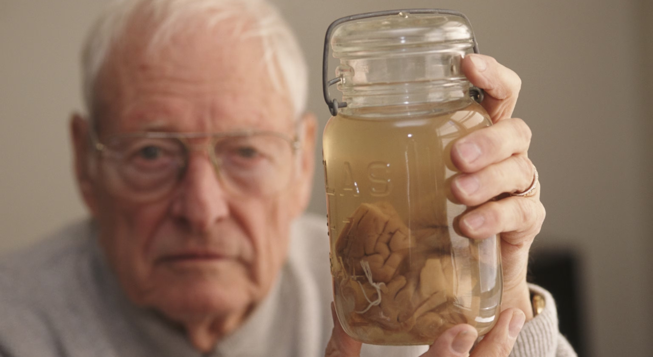 Albert Einstein’s brain was stolen by a doctor and carried around for 40 years