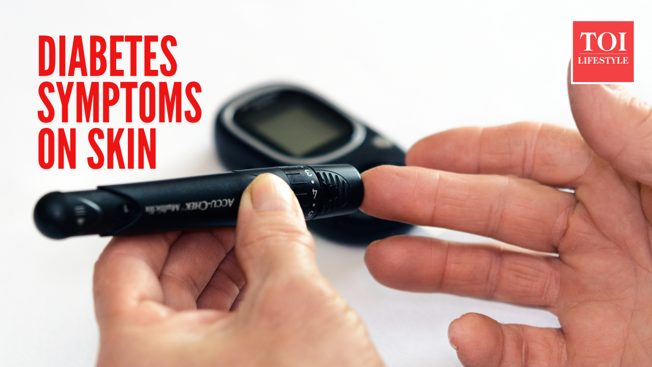 7 skin symptoms that may signal uncontrolled diabetes