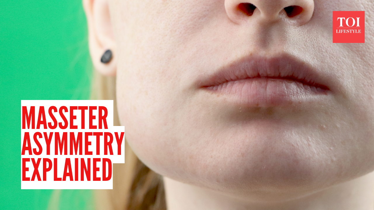 Masseter asymmetry explained: How chewing habits can subtly reshape your face