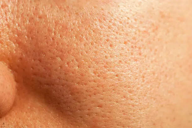 istockphoto-152951254-612x612