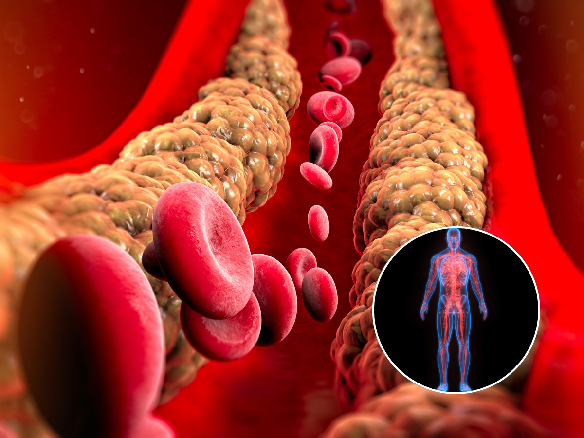 Scientists Just Found a “Cholesterol Traffic Jam” That Can Wreck the Brain​