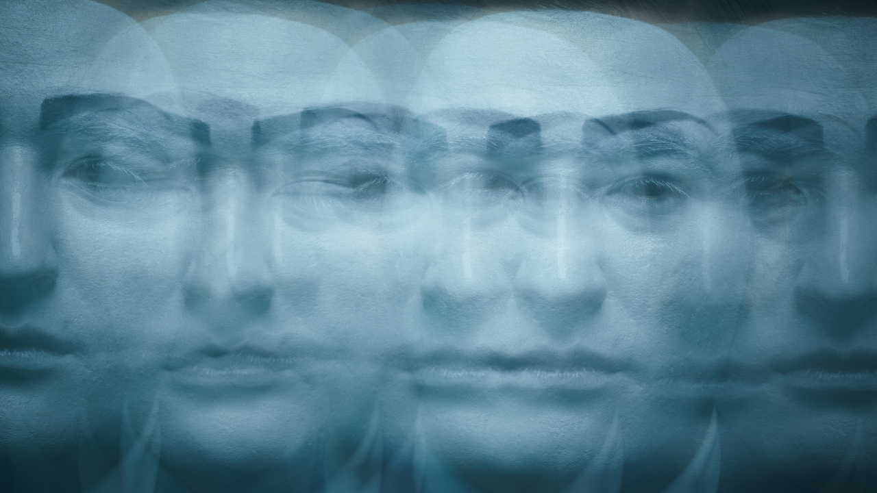 When the brain sees faces everywhere: How visual snow syndrome amplifies pareidolia