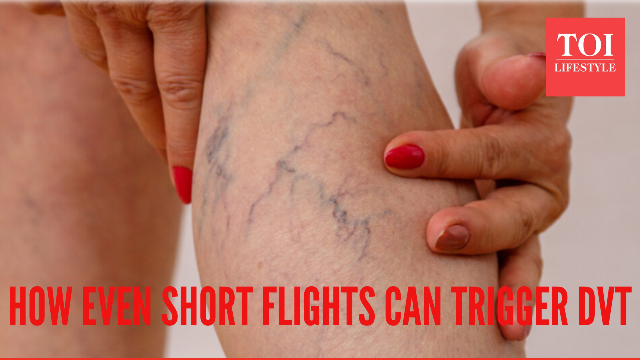 Woman lands in hospital with Deep Vein Thrombosis after a one-hour flight; Top doctor reveals why this happens