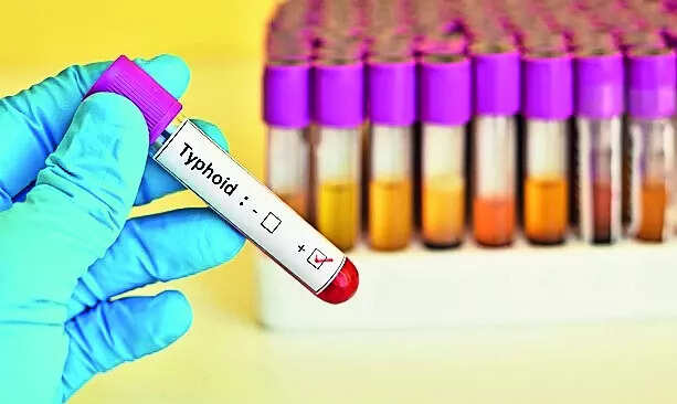 Typhoid surge: 100 hospitalised in Guj, Shah reviews situation