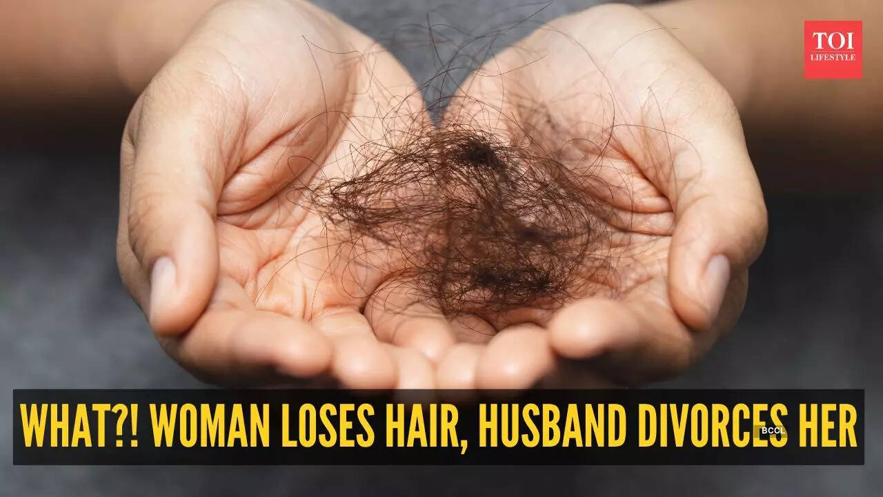 Bizarre! Husband divorces wife after she loses hair