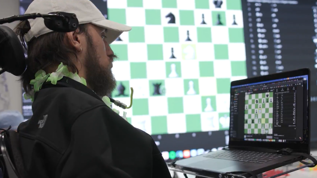 This shouldn’t be real: Paralysed patients play video games just by thinking after Neuralink transplant