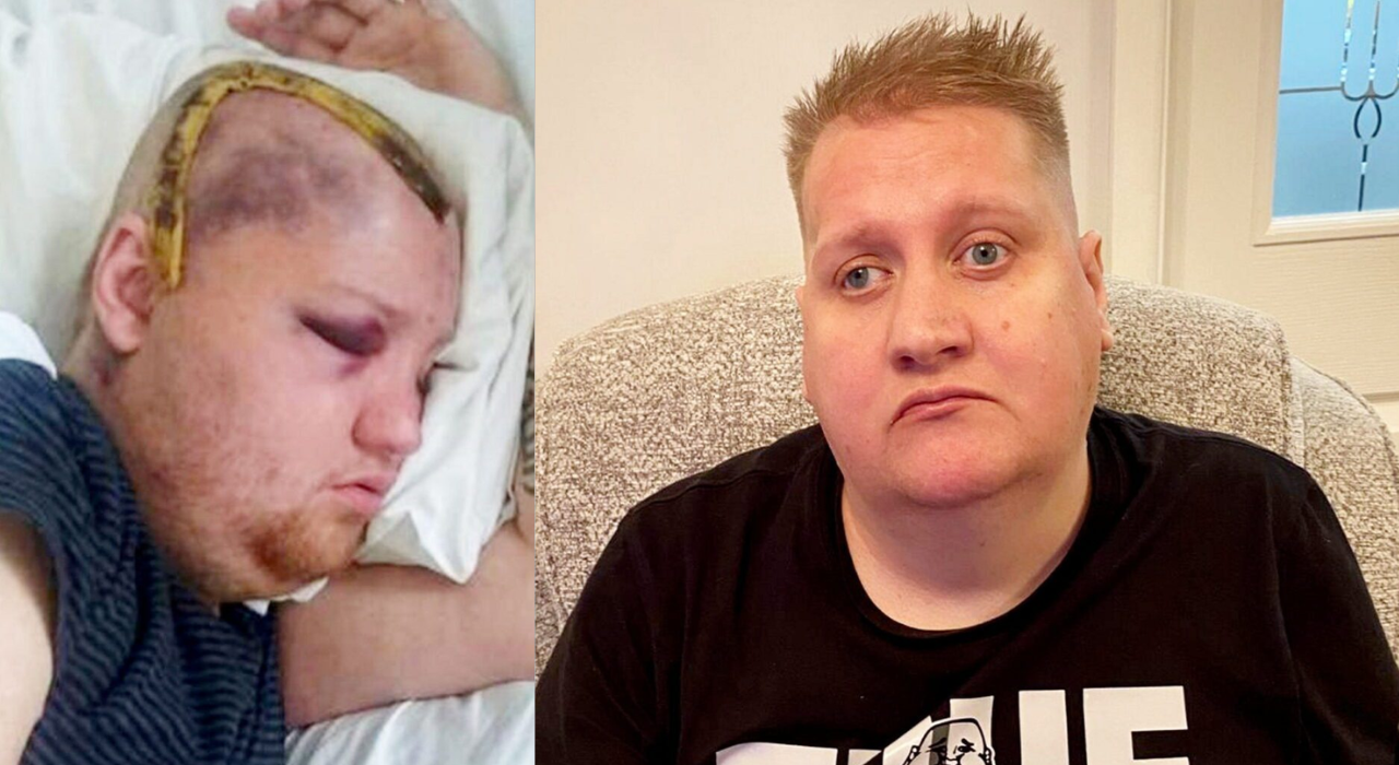 ‘It’s a nightmare’: UK man sues NHS after receiving eight years of chemotherapy instead of six months