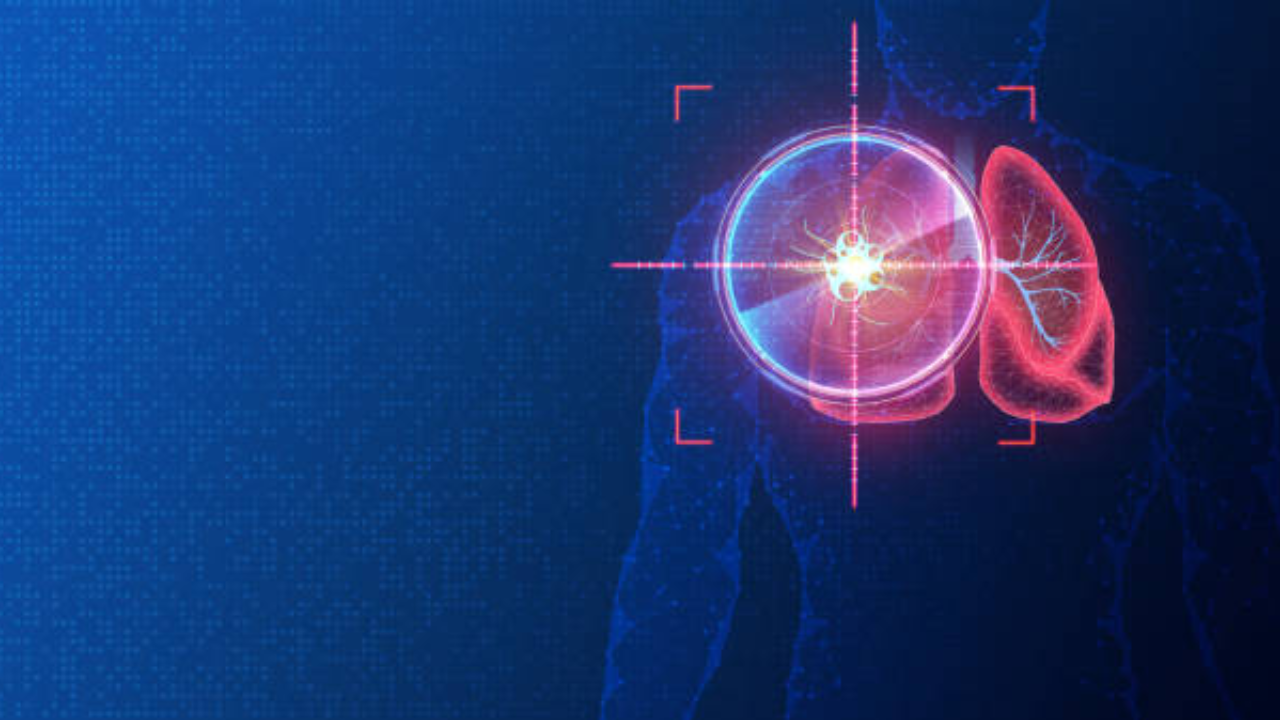 Precision oncology in cancer care: Doctors explain why it matters today