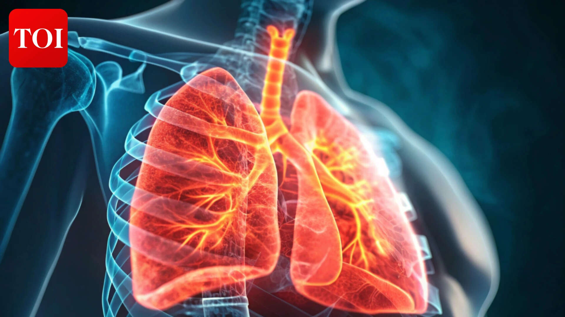 Worsened COPD symptoms