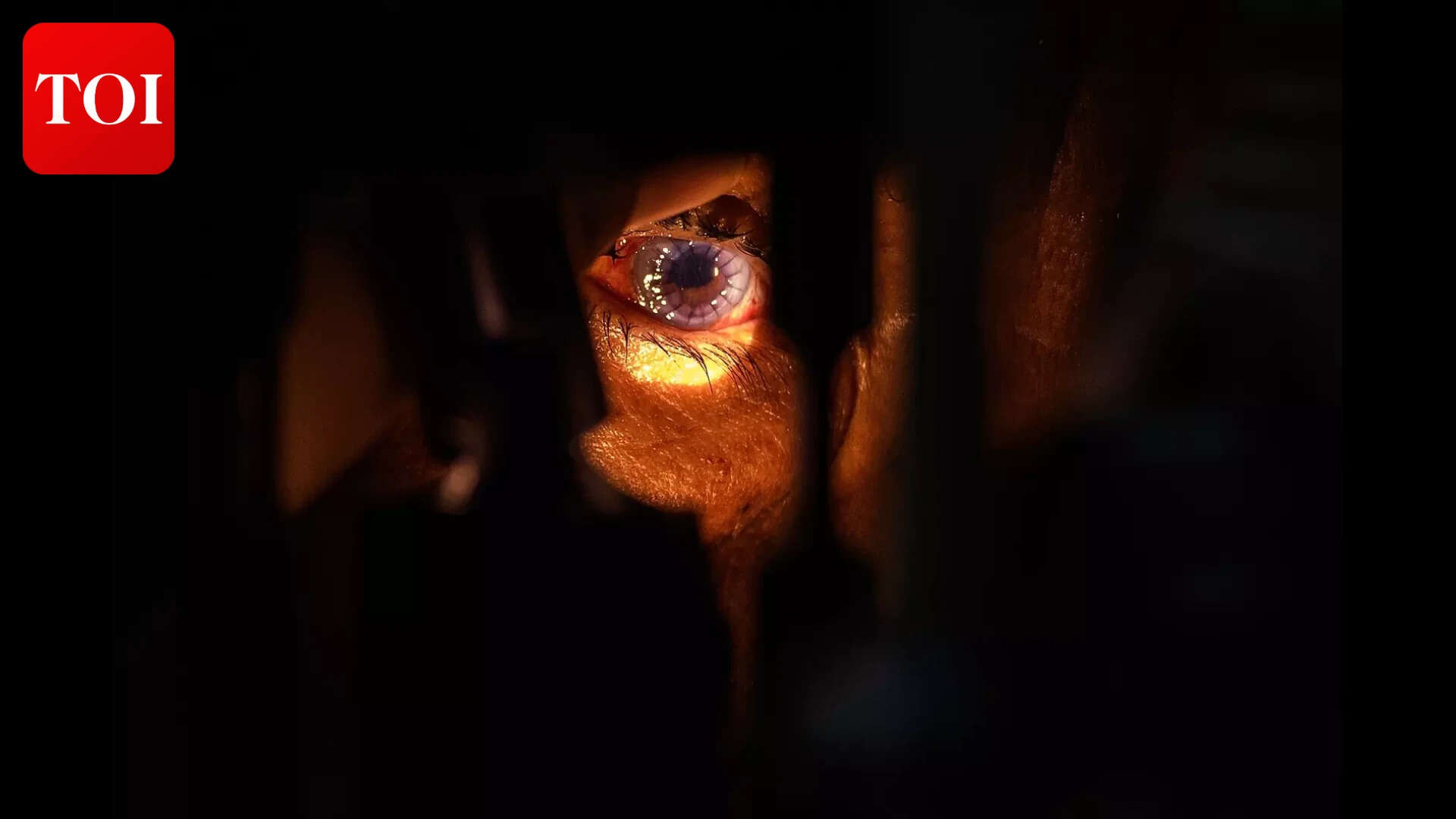 GMC seeks licence to register as corneal transplant centre