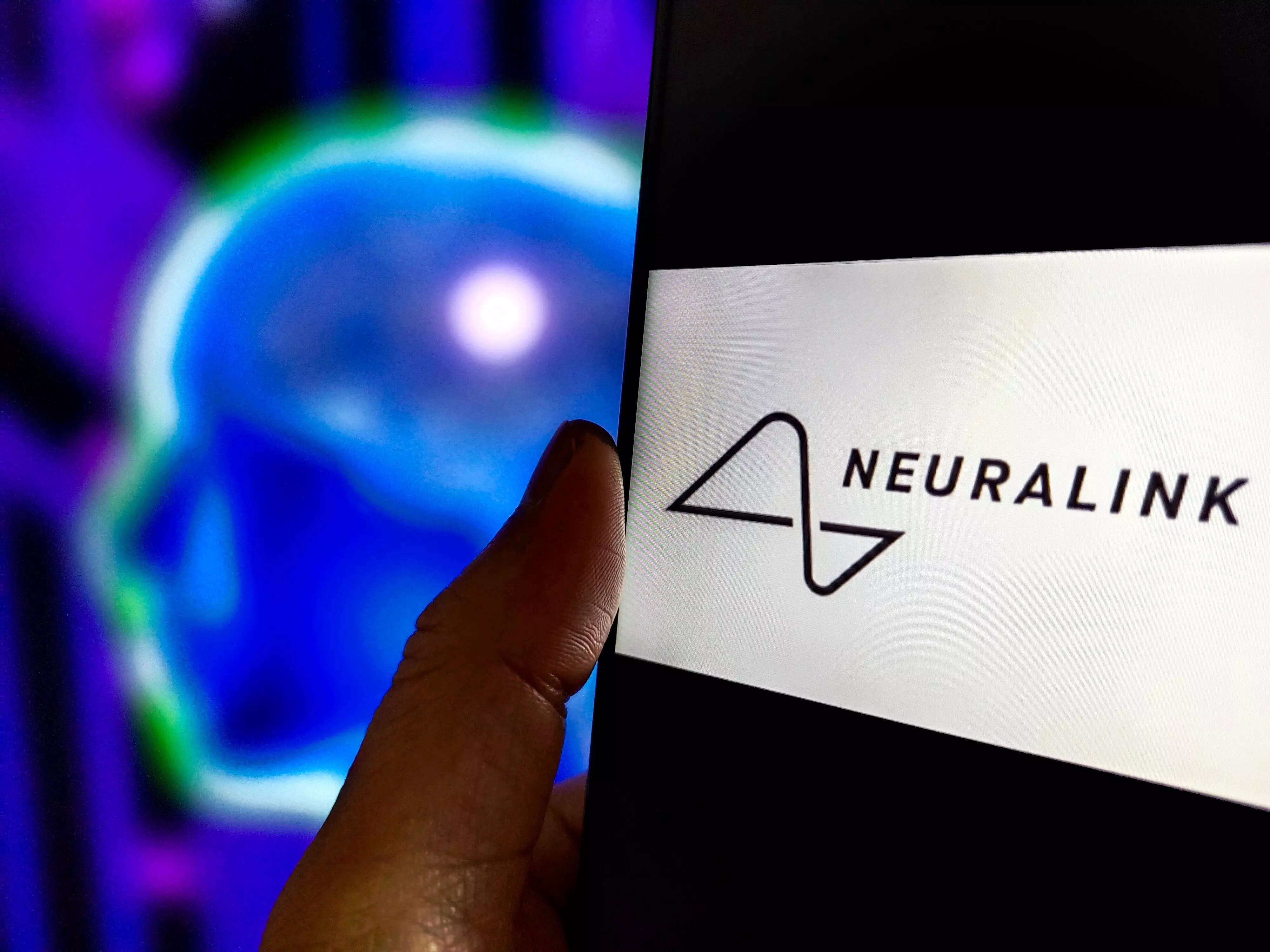 Elon Musk’s Neuralink patient Noland Arbaugh shares 100-day update