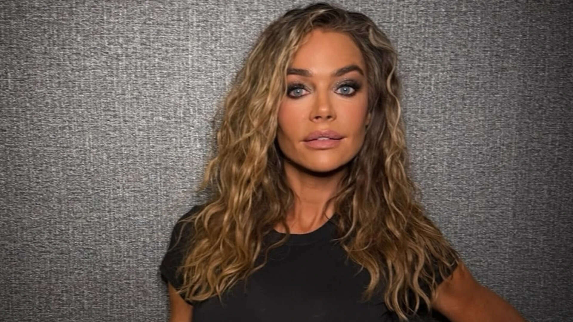 Denise Richards goes candid about her facelift surgery