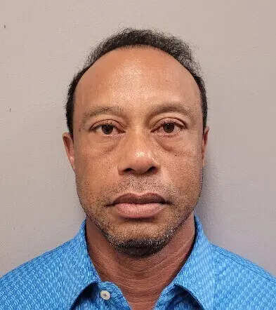 Tiger Woods had hydrocodone pills in his pocket and bloodshot eyes at crash scene, authorities say