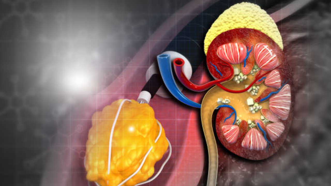 Scientists find promising new drug against rare, life-threatening kidney disease