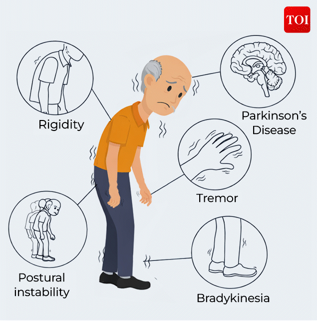 Parkinson's disease