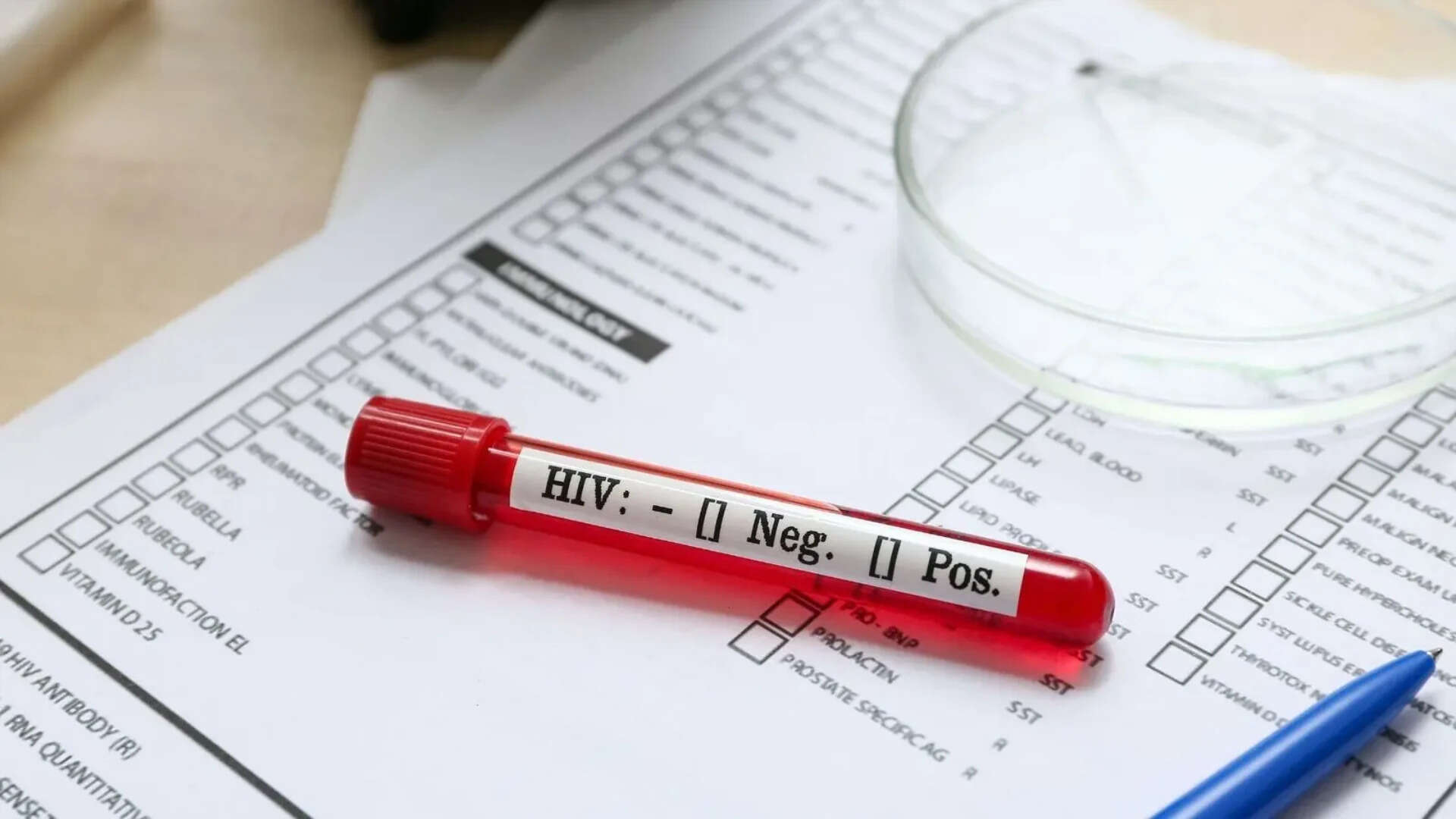 HIV test