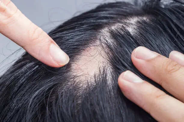 istockphoto-1264331025-612x612
