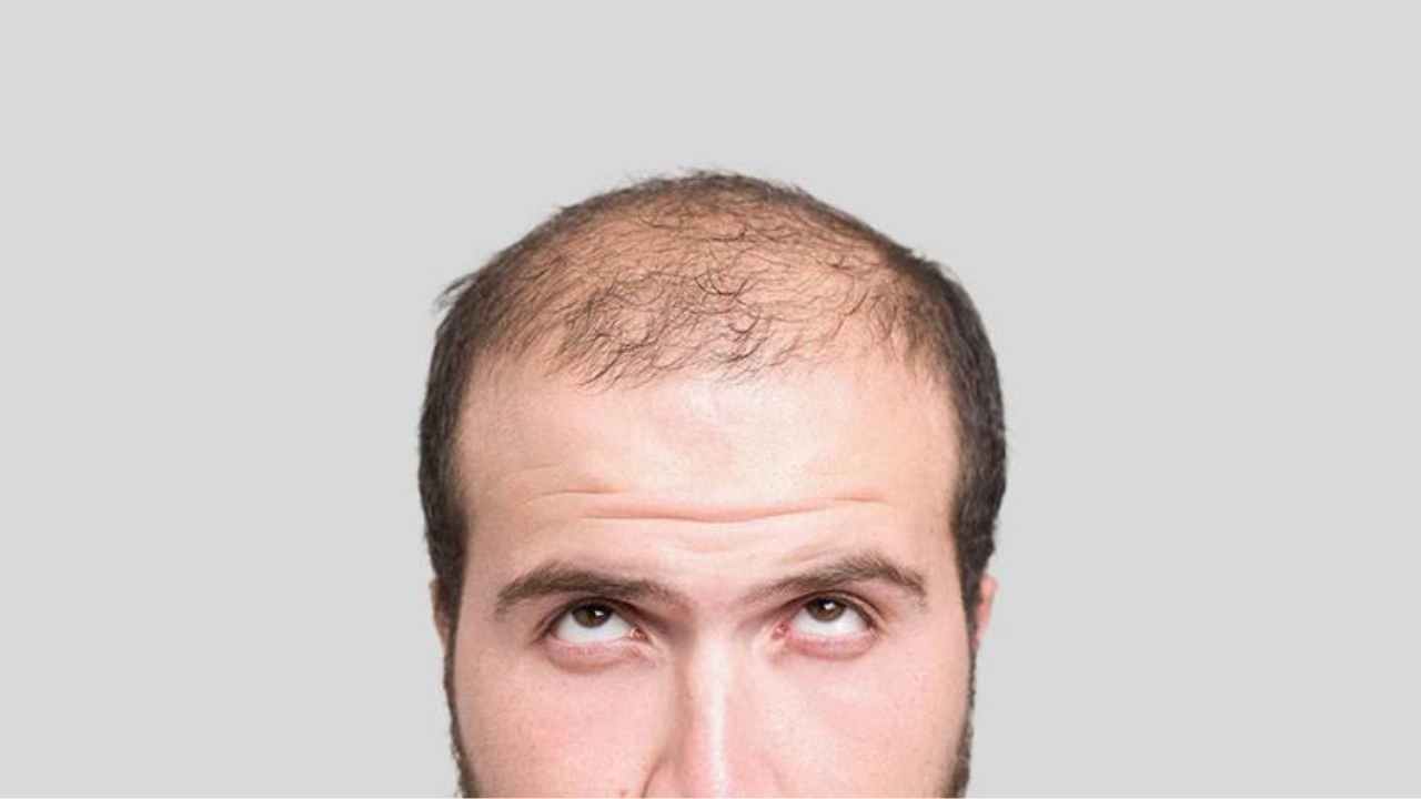 Is This Plant Based Serum, Fastest Way to Regrow Hair