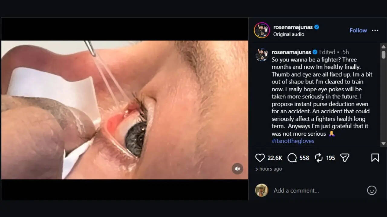 Rose Namajunas injury update