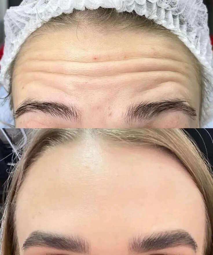 No Surgery, No Downtime: The New Age-Defying Treatments Taking Over Beauty Clinics