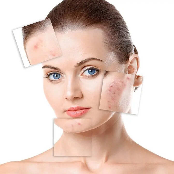 Recurrent Skin Flare-Ups: Understanding the Root Causes Beyond Topical Treatments
