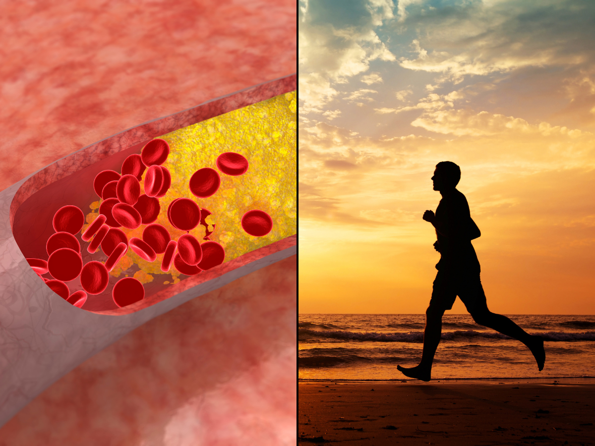 Is Your Cholesterol Skyrocketing in Your 20s? The Silent Epidemic Among Youngsters