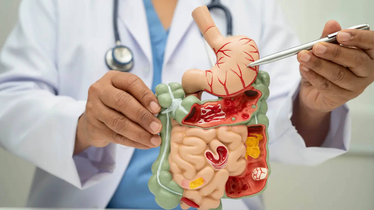 肠道健康：消化缓慢？哈佛医生揭晓 10 分钟修复方法