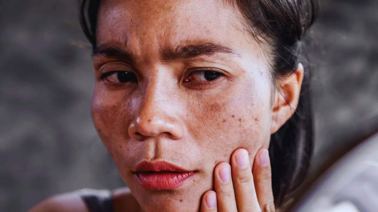 Deficiencies are the root cause of pigmentation (Canva)