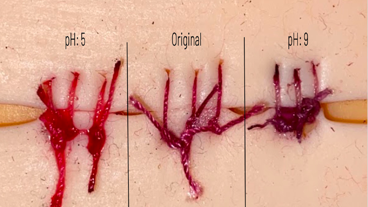 Under infection-like pH conditions, the cotton-polyester thread changed from bright red to dark purple within five minutes.