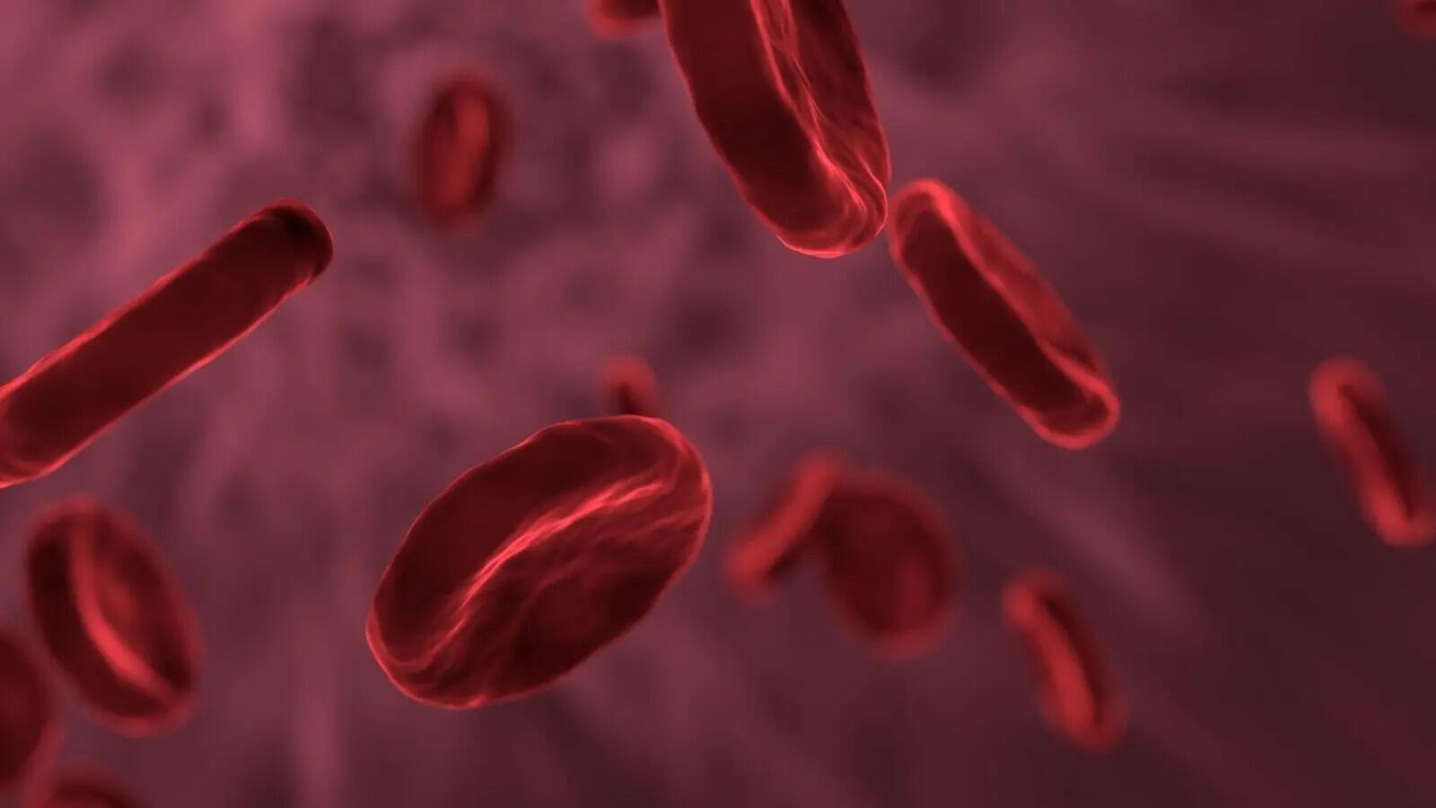 Thalassemia