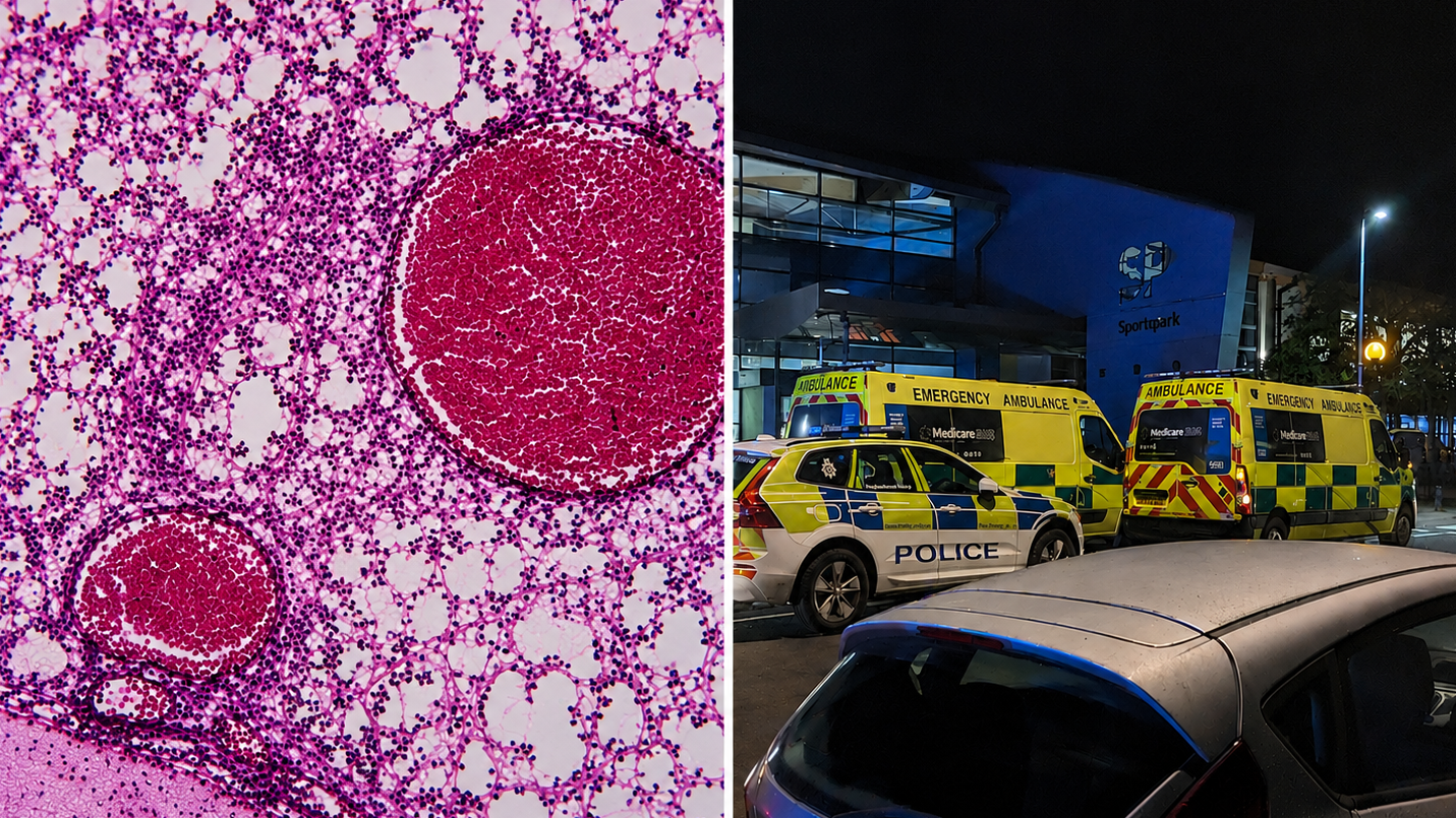 Meningitis outbreak sparks alarm after student dies and 2 others fall ill in Reading Area