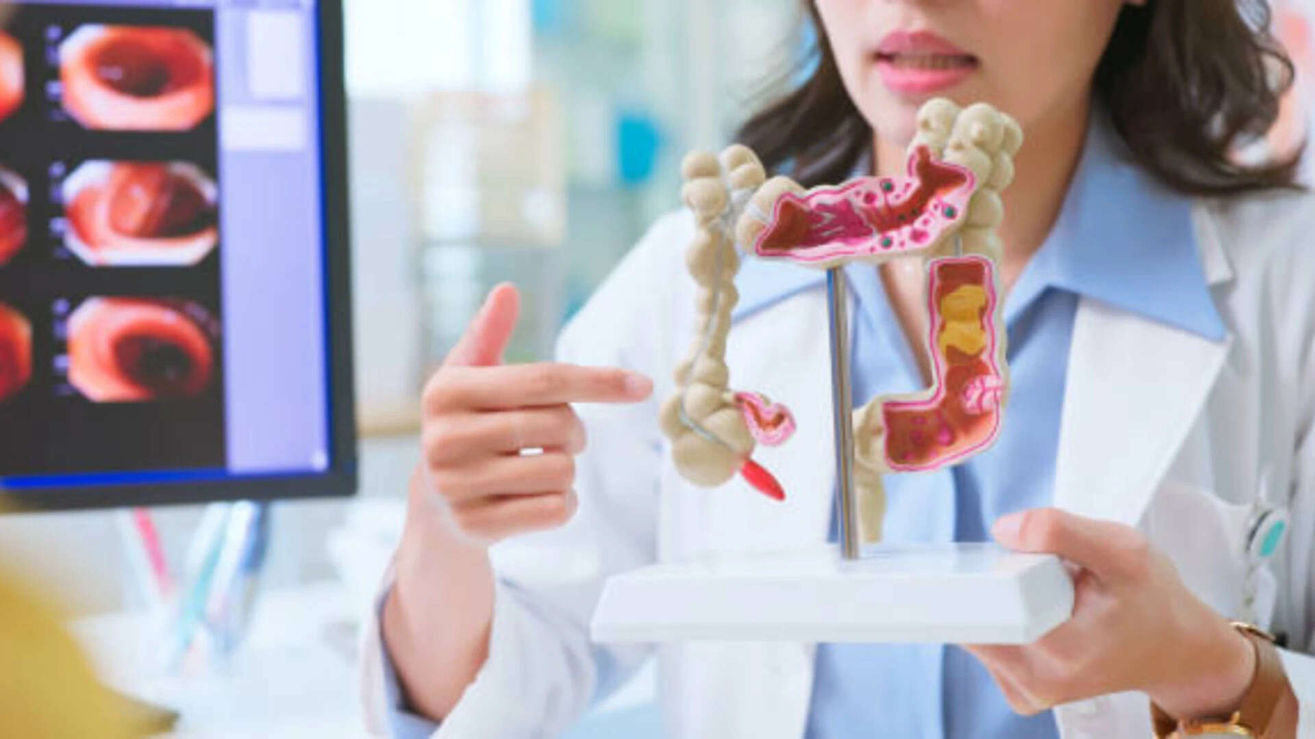 Colon cancer