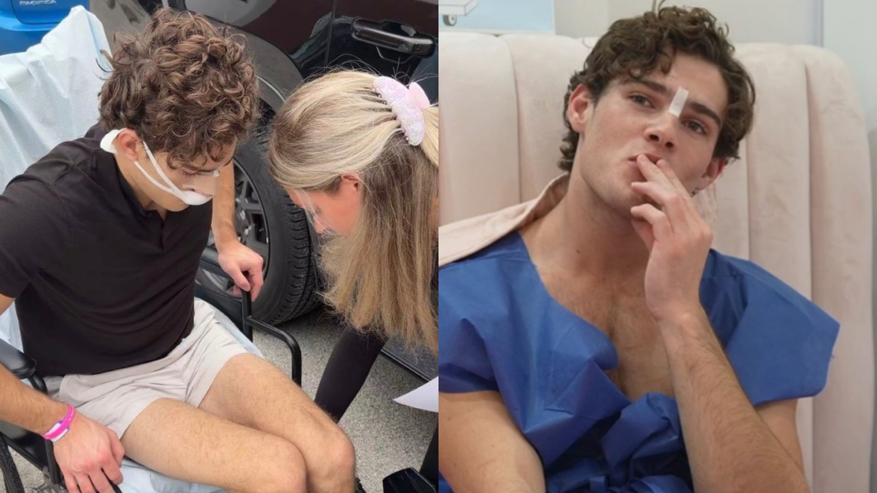 The Broken Bones of Modern Masculinity