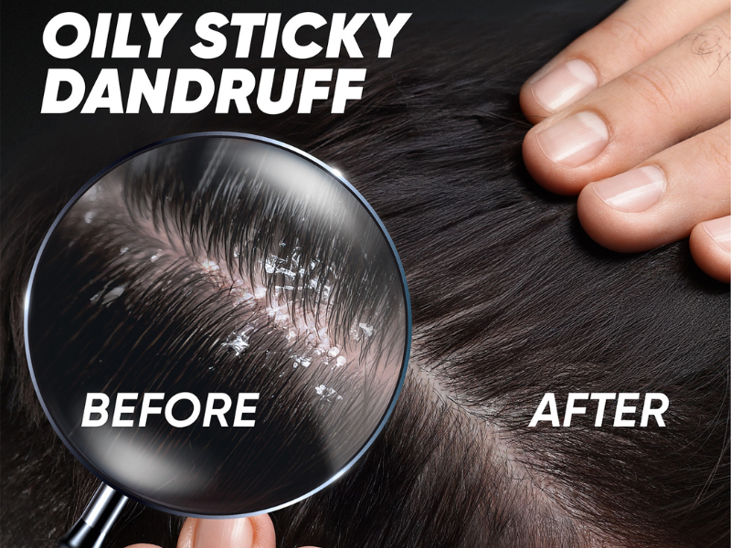 Benefits of Head & Shoulders Deep Clean Shampoo