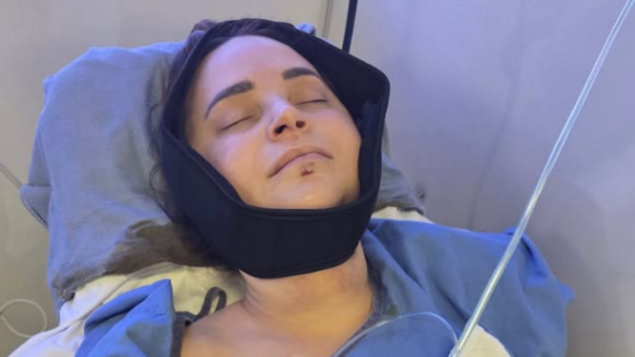 YouTuber Rosanna Pansino Undergoes Jaw Surgery After Boat Accident