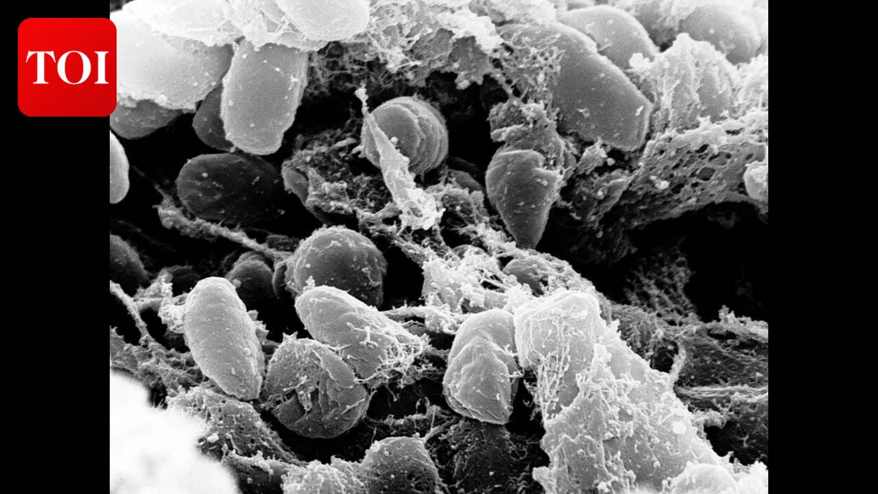 Wikimedia Commons Yersinia pestis