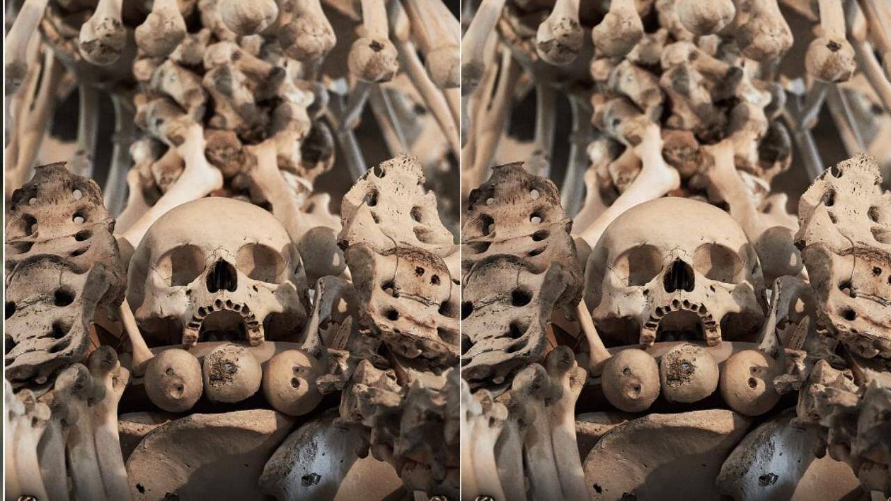 Bone