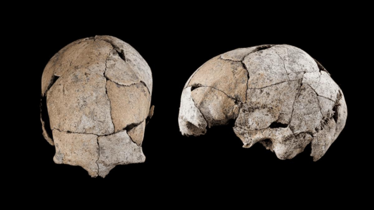 Buried for 5,300 years beneath a Stone Age tomb, a skull discovered in Spain has revealed the world's earliest known ear surgery